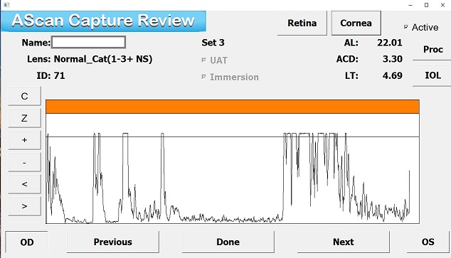 Immersion A-Scan Biometer Screen