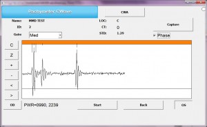 Pachymeter-corneal-waveform-with-phase-info-300x184