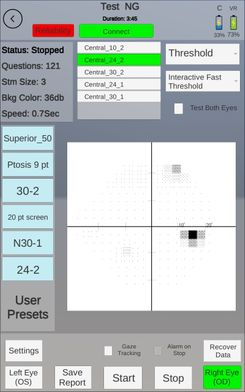 VF2000 VR visual field Palmscan test data results