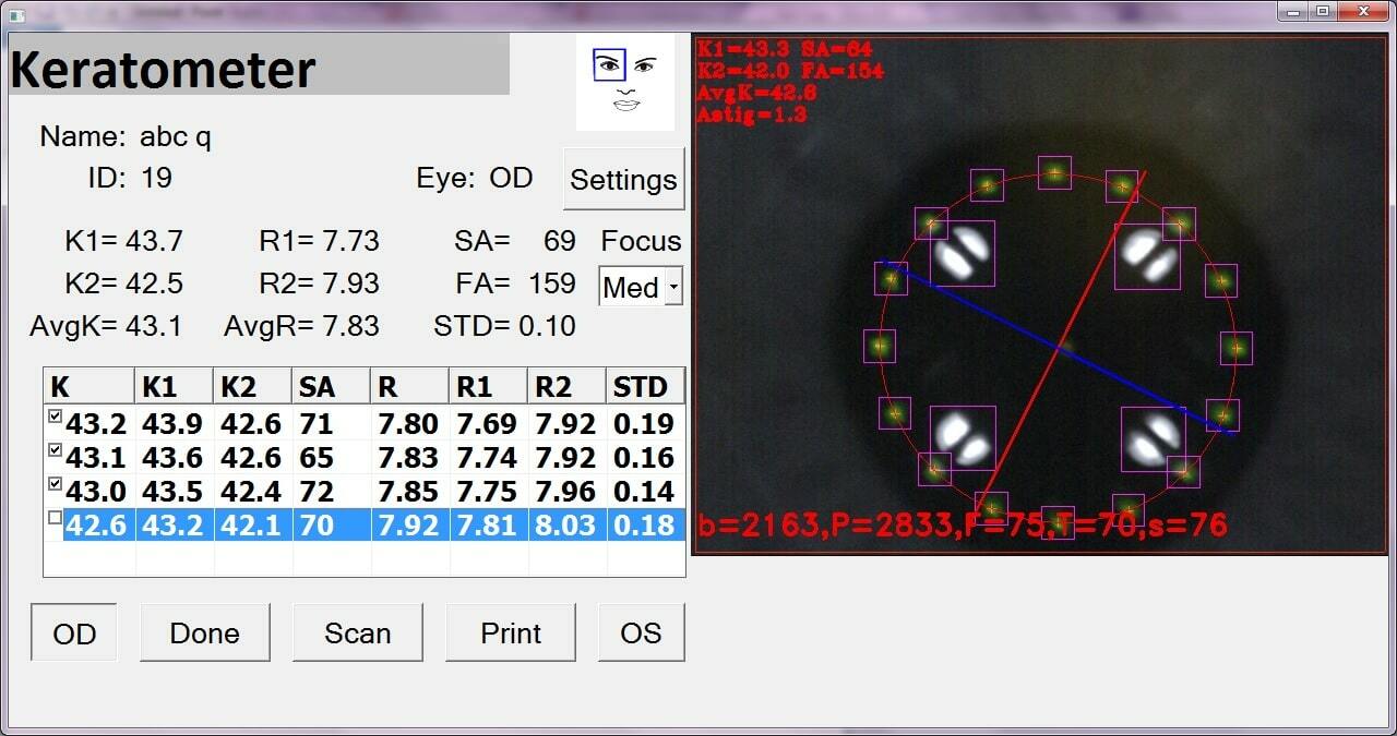Keratometer-Screen-Capture2