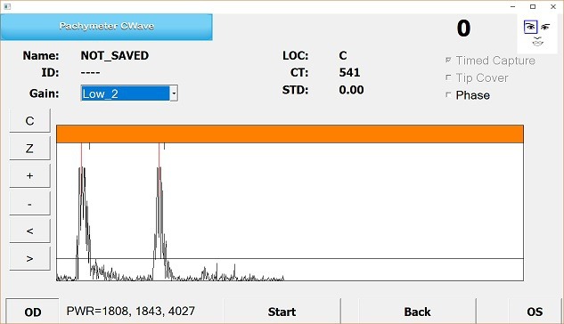 Pachymeter c wave report from micro medical devices
