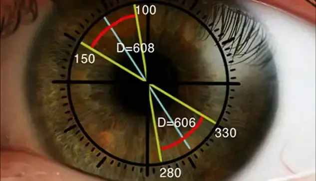 A close-up of a brown eye with overlaid angle measurements, lines, and numbers marking 100, 150, 280, and 330 degrees, as well as two distances labeled D=608 and D=606.