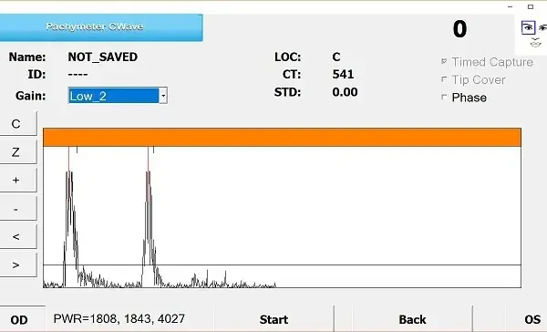 Screenshot of a Pachymeter CWave software interface showing a graph with peaks, measurement settings, patient info, and options for timed capture, tip cover, and phase on the right side. Displayed gain is Low_2.