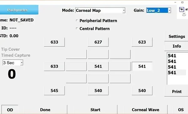 A screenshot of a pachymeter software interface showing corneal map mode, with various numerical readings in a grid, settings on the right, and options for name, ID, and time capture interval at the top left.