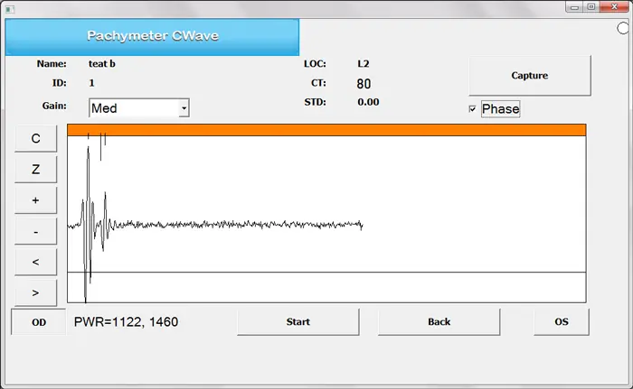 A computer screen shows a Pachymeter CWave interface with measurement data, a waveform graph, and controls for gain, phase, start, and capture. The power readings PWR=1122, 1460 appear at the bottom.