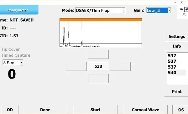Screenshot of a pachymeter interface displaying DSAEK/Thin Flap mode, Low_2 gain, measurement 538, and a graph. Other numbers shown are 537, 537, 537, and 540. Timer is set to 3 seconds.