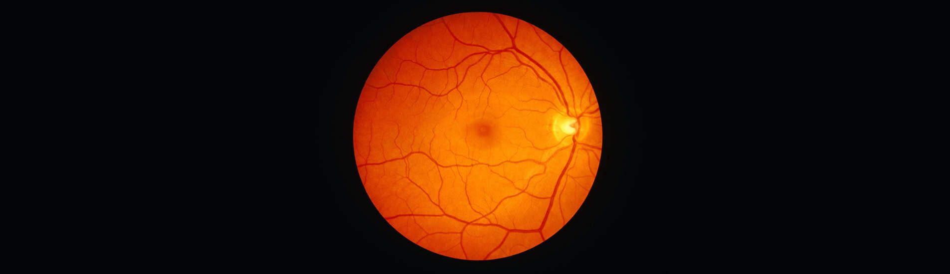 The Retina Specialist’s Secret Weapon: Why Everyone Loves Virtual Field